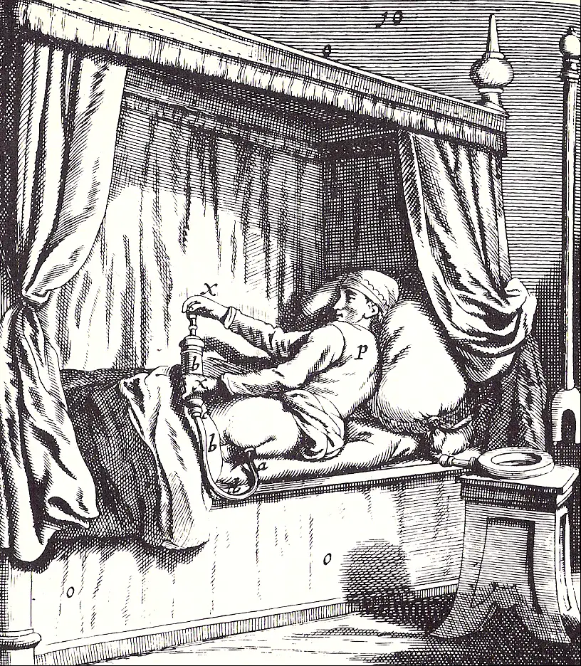 Usage d'un clystère pour un lavement au XVIIIème siècle - Cabinet Jun Li - Bien-être traditionnel chinois